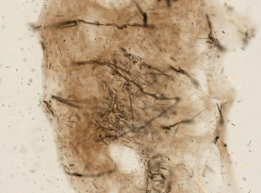 Lendenfeldia dendyi