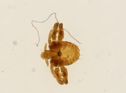 Pthirus pubis