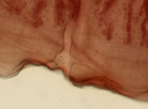 Taenia saginata