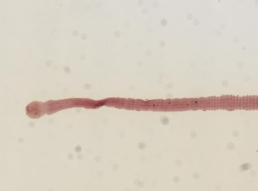 Raillietina tetragona