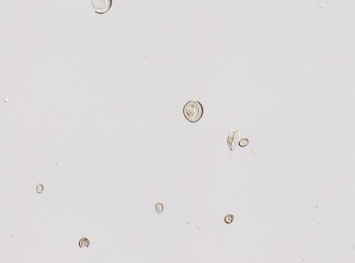 Cestoda
