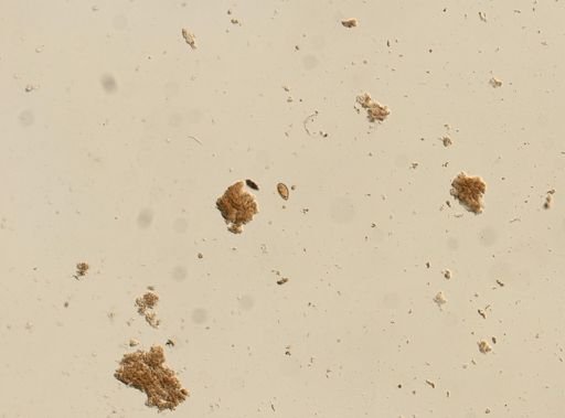 Diphyllobothrium canis