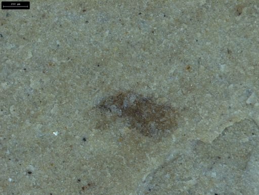 undet. Insecta