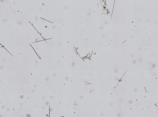 Tethya actinia