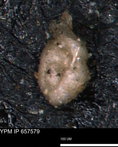 Glomospira reata