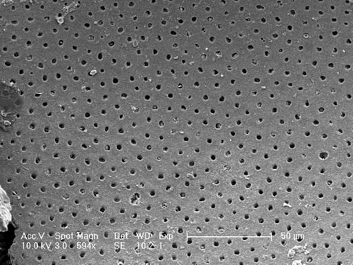 Globorotalia truncatulinoides