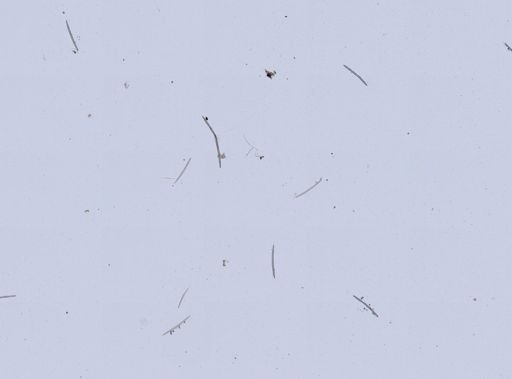 Spongilla fragilis