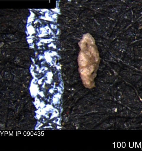 Verneuilina canadensis
