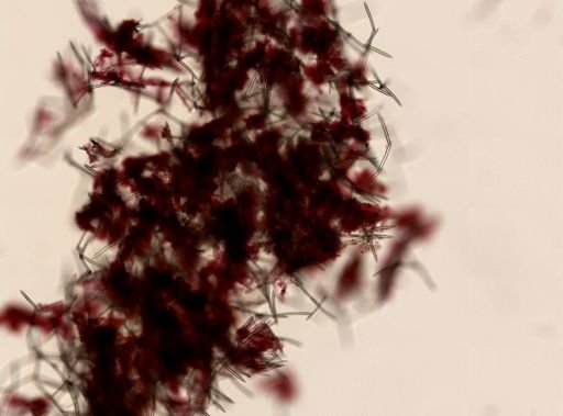 Haliclonidae