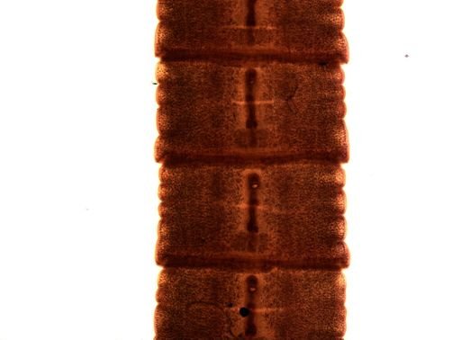 Diphyllobothrium erinacei