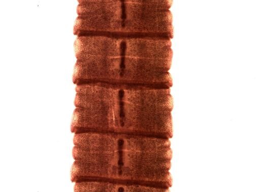 Diphyllobothrium erinacei