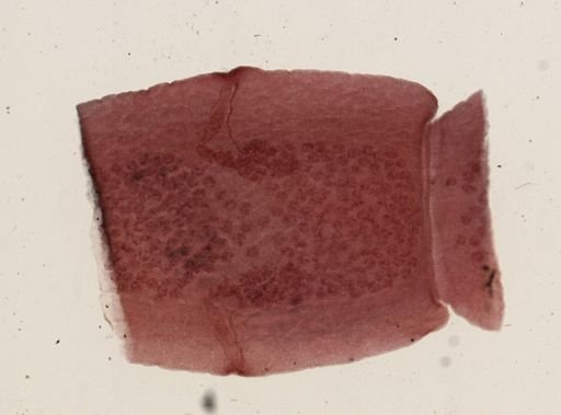 Dipylidium caninum