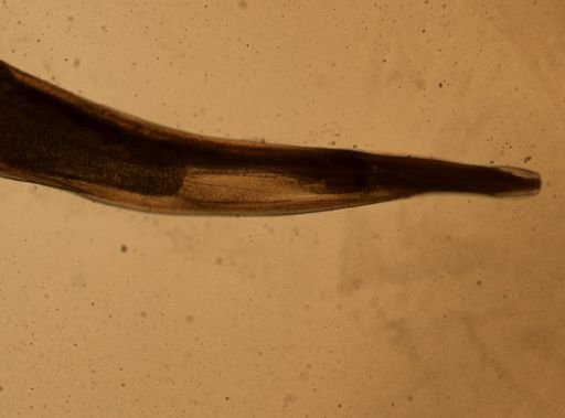 Enterobius vermicularis