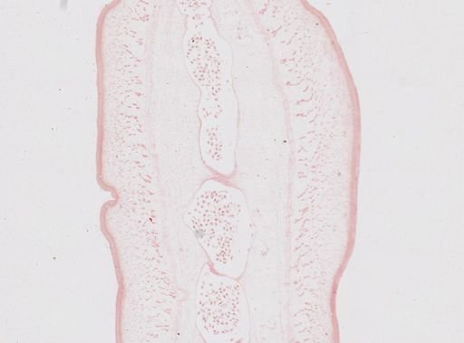 Taenia saginata