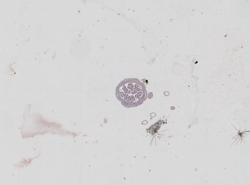 Nematostella