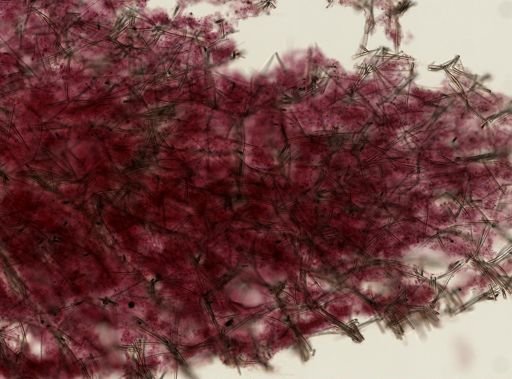 Axinella waltonsmithi
