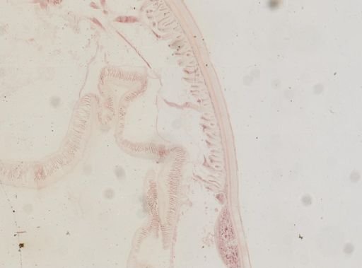 Ascaris megalocephala