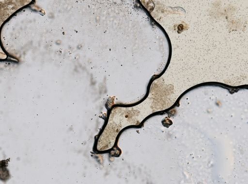 Strongyloides stercoralis