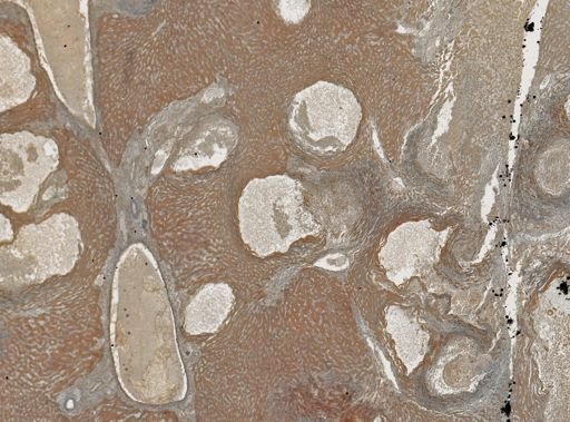Taenia taeniaeformis