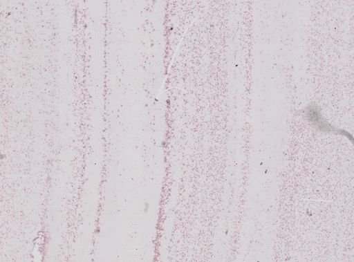 Babesia bigemina