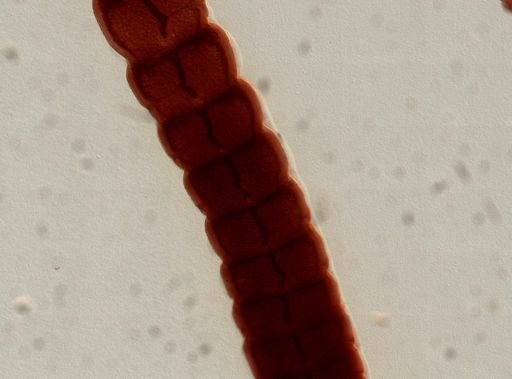 Eucestoda