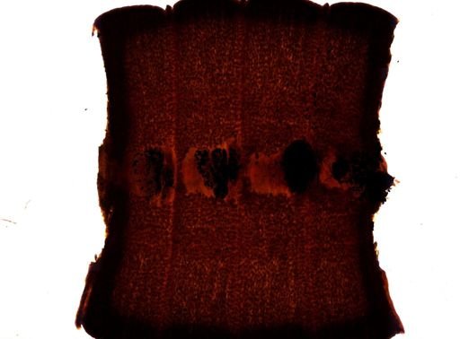 Diphyllobothrium erinacei