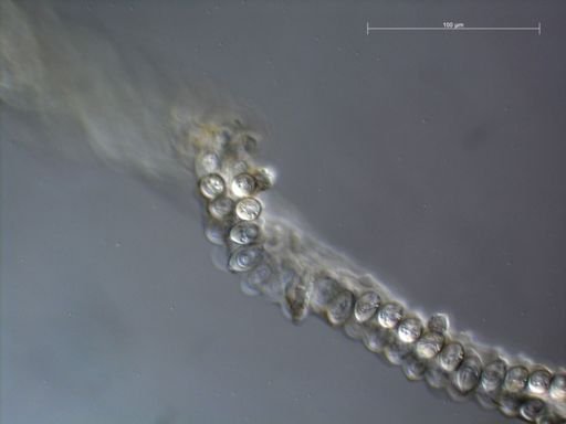 Apolemia lanosa