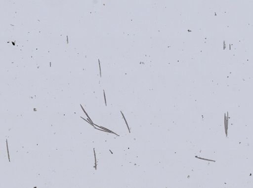 Spongilla lacustris