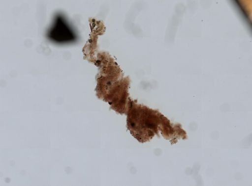 Porifera?