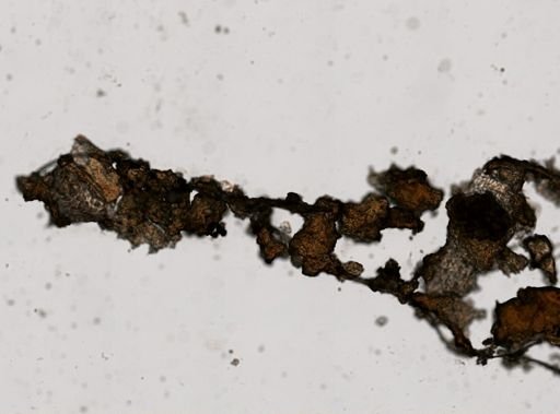 Trichuris trichiura