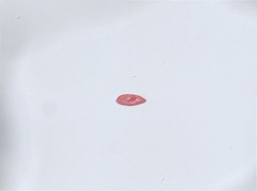 Paramecium aurelia