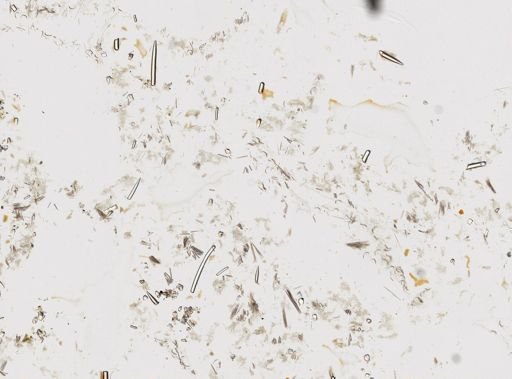 Biemna trirhaphis