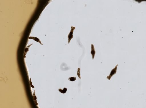 Bdelloidea