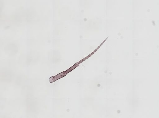 Hyalella cf. azteca