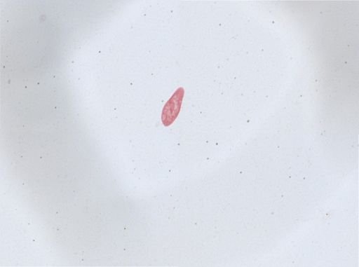 Paramecium aurelia
