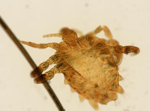 Pthirus pubis