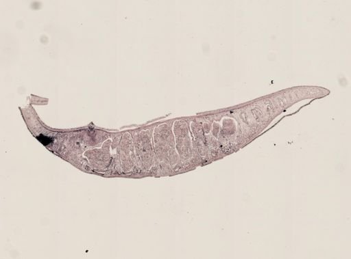 Hoploplana inquilina