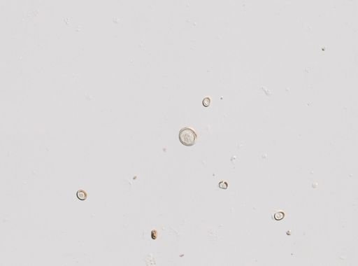 Cestoda