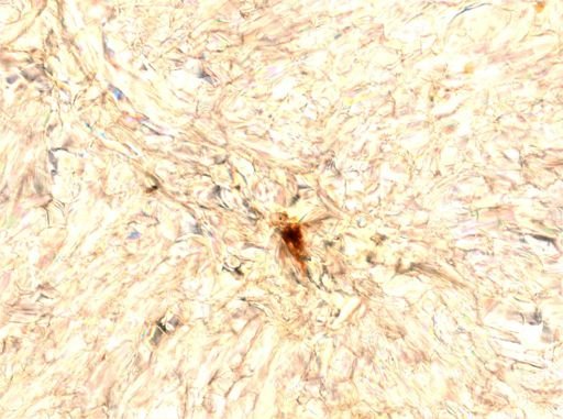 Dinobryon sp.