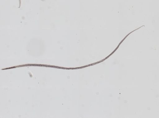 Trichinella spiralis