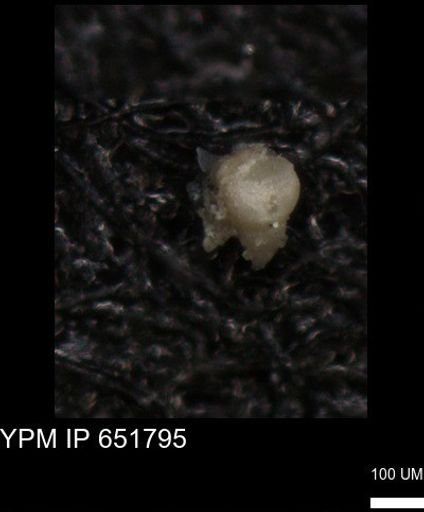 undet. Foraminiferida