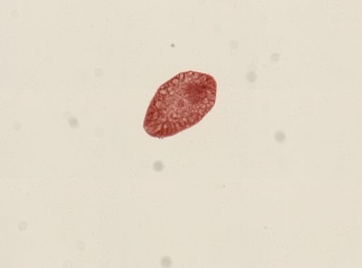 Tetracotyle