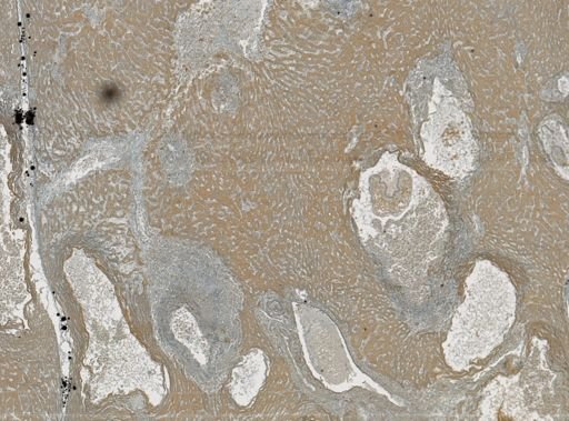 Taenia crassicollis