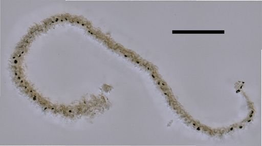 Rhizophysa eysenhardtii