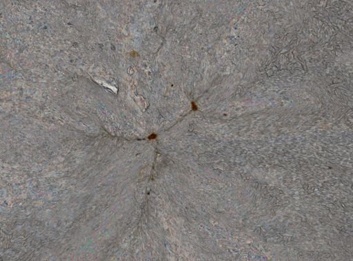 Euchlanis arenosa
