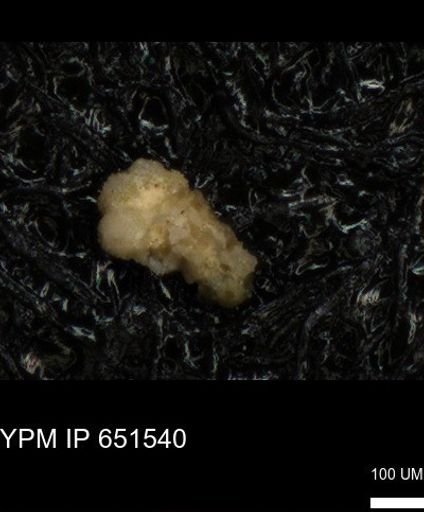 undet. Rugoglobigerinidae