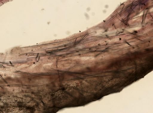 Jaspis stellifera