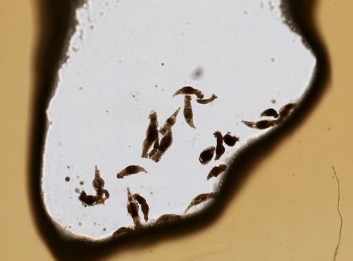 Bdelloidea