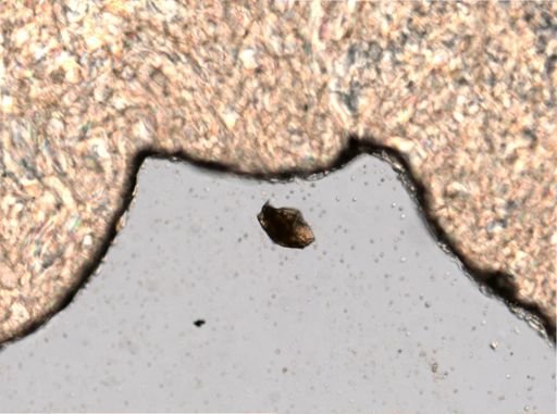 Ploesoma lenticulare