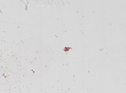 Ciliophora